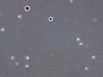 Sample image from VISEM-Tracking