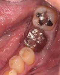 Sample image from Dentalai