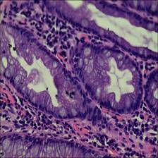 Sample image from EBHI-Seg