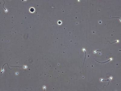 Sample image from VISEM-Tracking