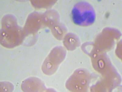 Sample image from BCCD
