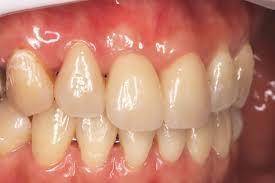 Sample image from Dentalai