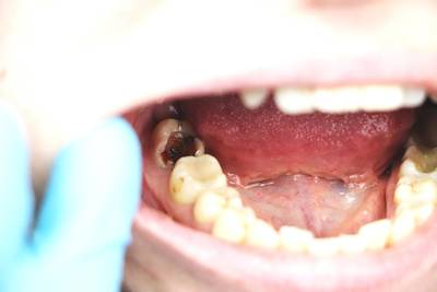 Sample image from Dentalai