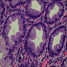 Sample image from EBHI-Seg