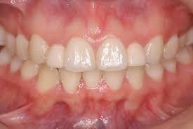 Sample image from Dentalai