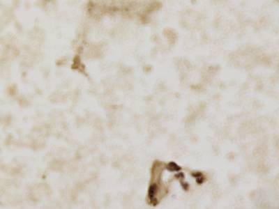 Sample image from CCAgT