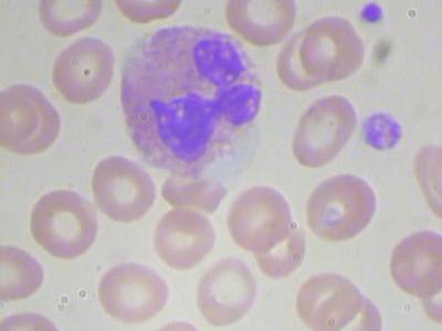 Sample image from BCCD