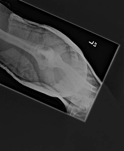 Sample image from Bone Classification and Detection Dataset
