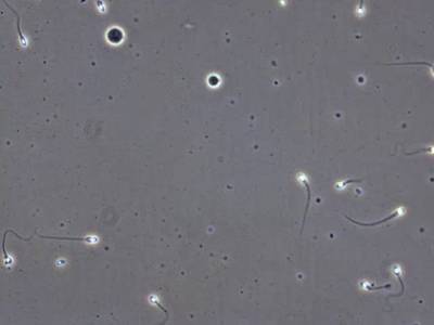 Sample image from VISEM-Tracking