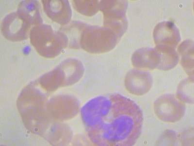 Sample image from BCCD