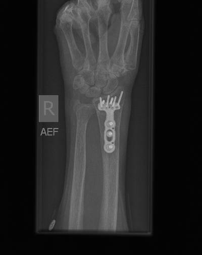Sample image from Bone Classification and Detection Dataset