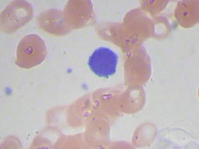 Sample image from BCCD
