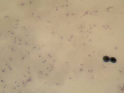 Sample image from Microscopy Malaria Dataset