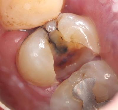Sample image from Dentalai