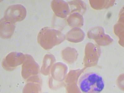 Sample image from BCCD