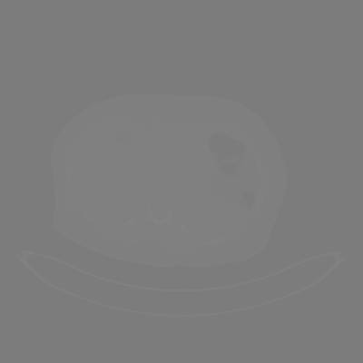 Sample image from DeepLesion