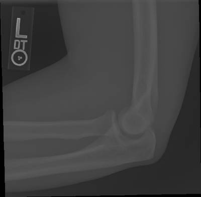 Sample image from Bone Classification and Detection Dataset