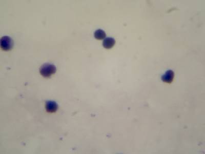 Sample image from Microscopy Malaria Dataset