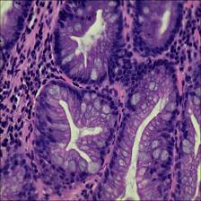 Sample image from EBHI-Seg