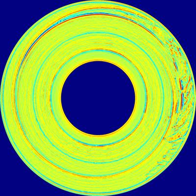 Sample image from BTAD