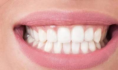 Sample image from Dentalai