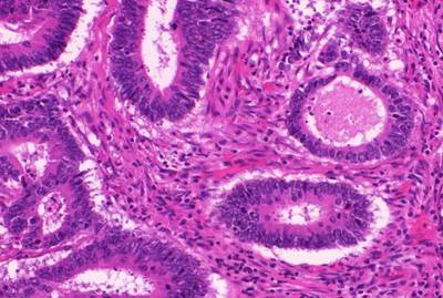 Sample image from GlaS@MICCAI'2015: Gland Segmentation