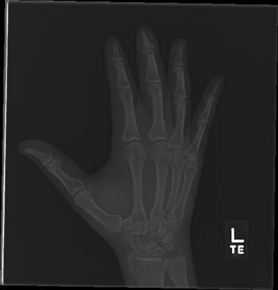 Sample image from Bone Classification and Detection Dataset