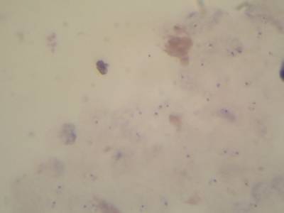 Sample image from Microscopy Malaria Dataset