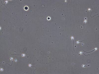 Sample image from VISEM-Tracking