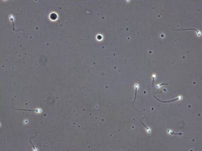 Sample image from VISEM-Tracking