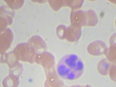 Sample image from BCCD
