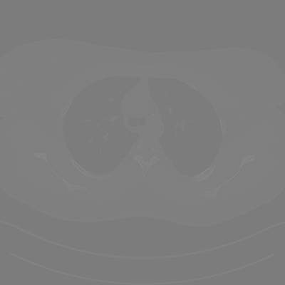Sample image from DeepLesion