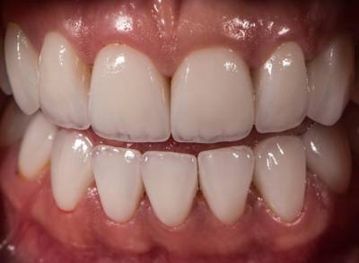 Sample image from Dentalai