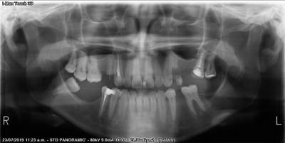 Sample image from Teeth Segmentation on Dental X-ray Images