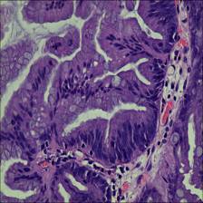 Sample image from EBHI-Seg