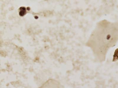 Sample image from CCAgT