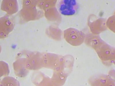 Sample image from BCCD