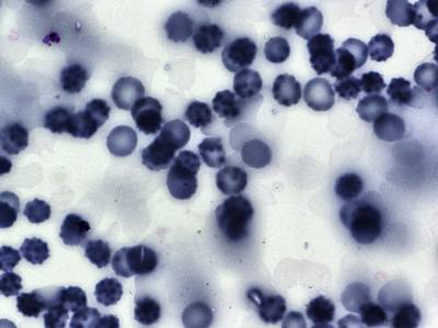 Sample image from BBBC041Seg