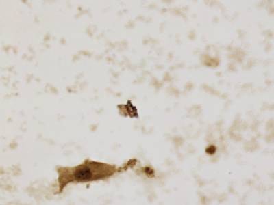 Sample image from CCAgT