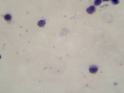 Sample image from Microscopy Malaria Dataset