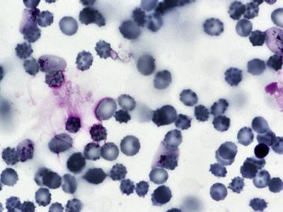 Sample image from BBBC041Seg