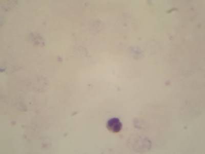 Sample image from Microscopy Malaria Dataset