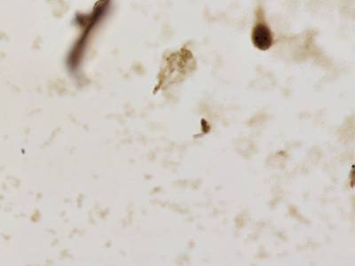 Sample image from CCAgT