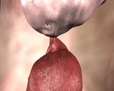 Sample image from SISVSE