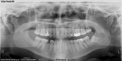 Sample image from Teeth Segmentation on Dental X-ray Images