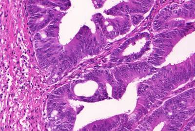 Sample image from GlaS@MICCAI'2015: Gland Segmentation