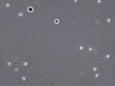 Sample image from VISEM-Tracking
