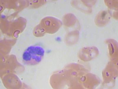 Sample image from BCCD