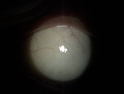 Sample image from Eyes Microcirculation