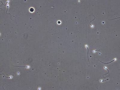 Sample image from VISEM-Tracking